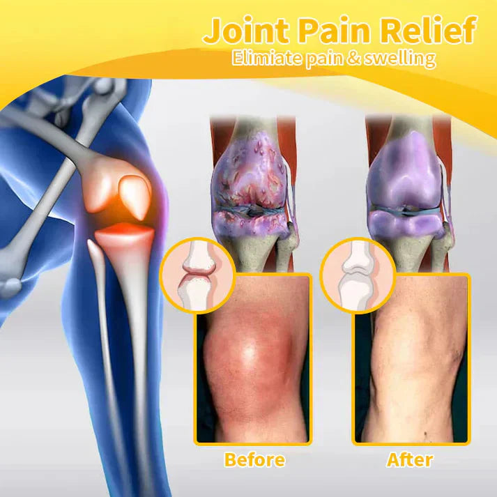VENOLYX™ Bee Venom Rapid Therapy Joint Cream|Deep Penetration for Joint Repair