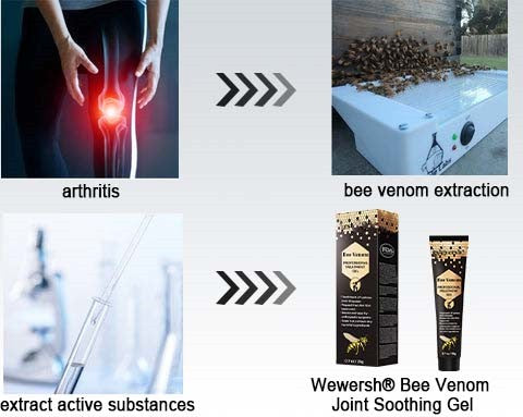 🐝MOONBIFFY™ New Zealand Bee Venom Joint Relief Gel(New Zealand Bee Extract - Specializes in the treatment of orthopedic conditions and arthritic pain)