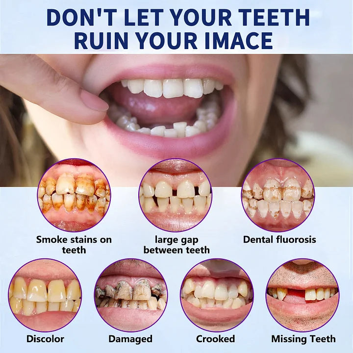 SmileFitPro™-New Generation Flexible Full Denture Solution