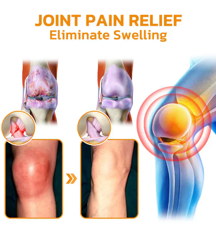 VENOLYX™ Bee Venom Rapid Therapy Joint Cream|Deep Penetration for Joint Repair