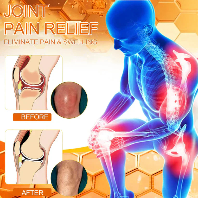 VENOLYX™ Bee Venom Rapid Therapy Joint Cream|Deep Penetration for Joint Repair