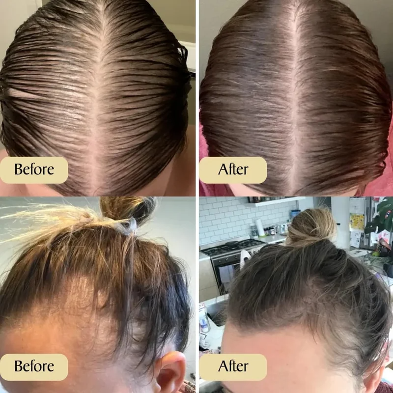✨HerbaRootia™ Natural Hair Growth Oil (Last day to get over 🔥49% OFF)