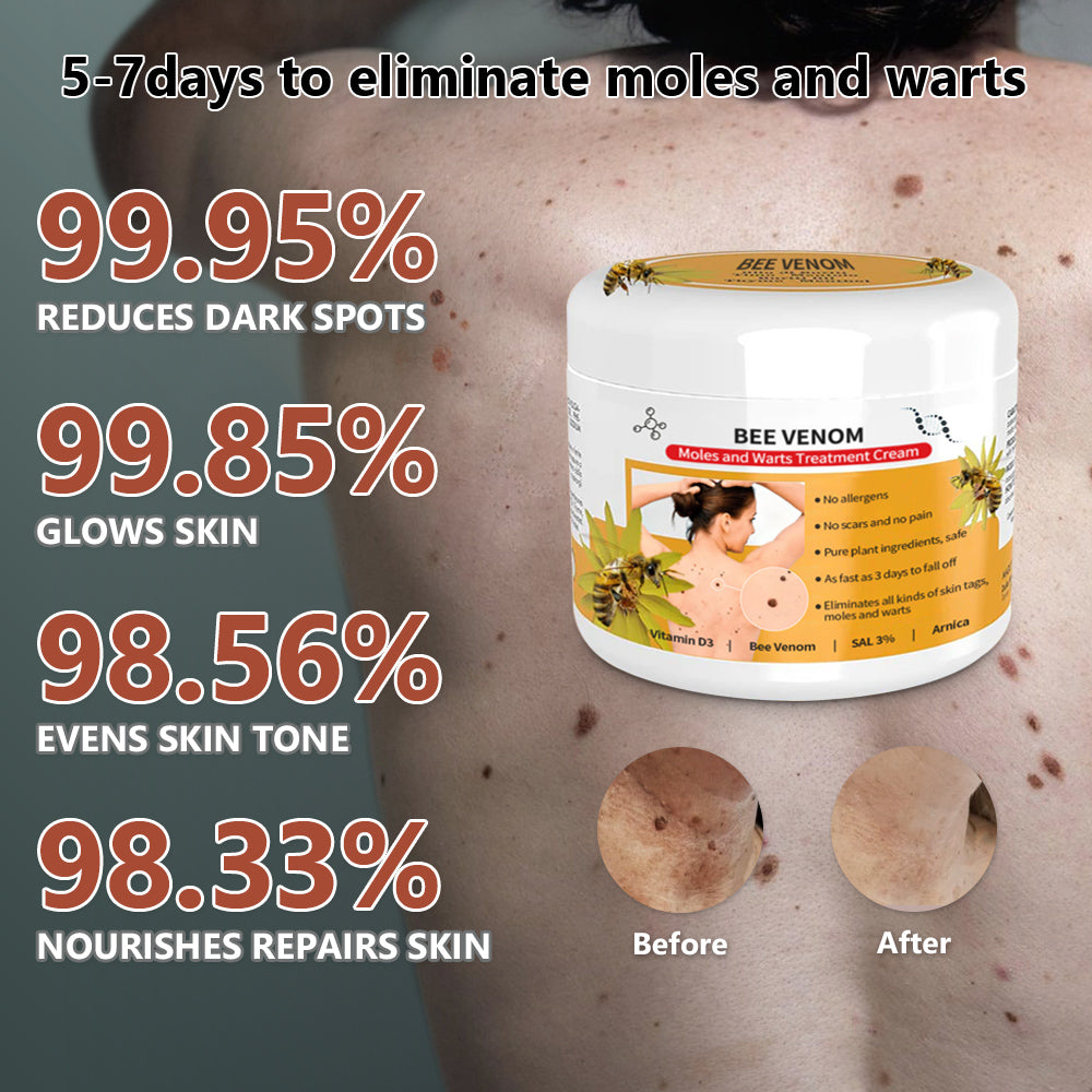 🐝🐝Bee Venom Mole and Wart Treatment Cream