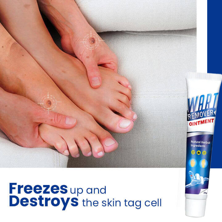 QuickAway™ Instant Skin Tags & Warts Removal Cream - No Scars, No Pain!