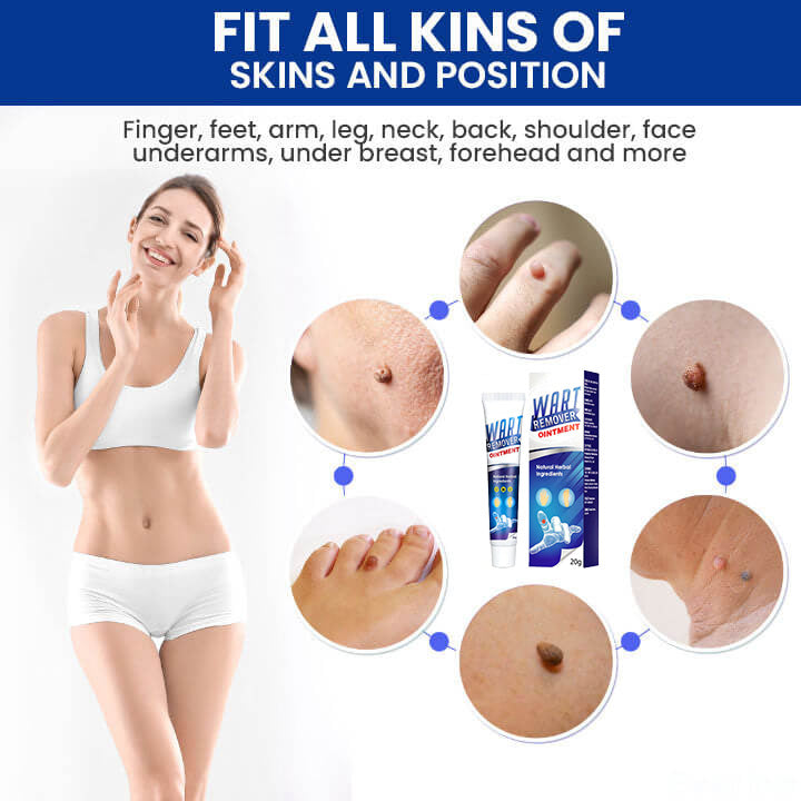 QuickAway™ Instant Skin Tags & Warts Removal Cream - No Scars, No Pain!