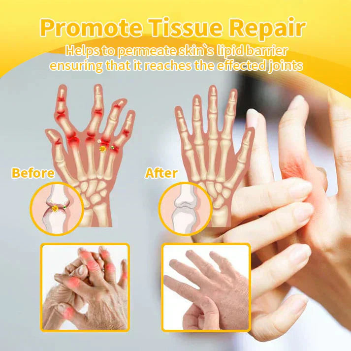 VENOLYX™ Bee Venom Rapid Therapy Joint Cream|Deep Penetration for Joint Repair