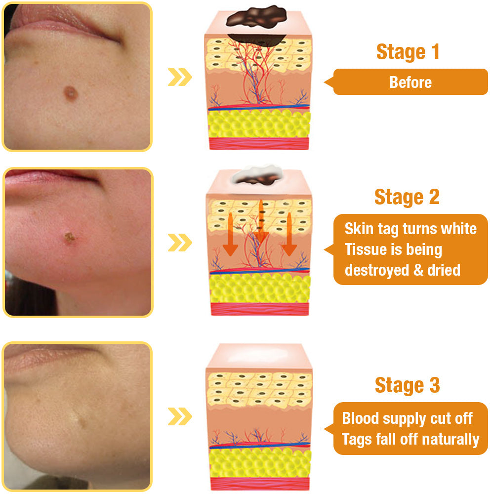 š VenoRevive⢠Tag Recede Bee Venom Treatment Spray(š„Limited Time Discount š„ Last Dayš„)