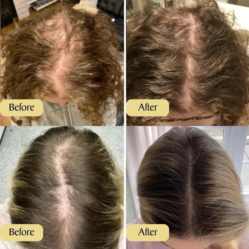 ✨HerbaRootia™ Natural Hair Growth Oil (Last day to get over 🔥49% OFF)