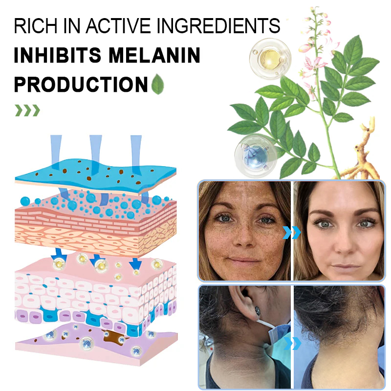 NESLEMY™ Purifying Exfoliating Gel for Acanthosis Nigricans, Exfoliation, Dark Spots, Skin Tags, and Eczema