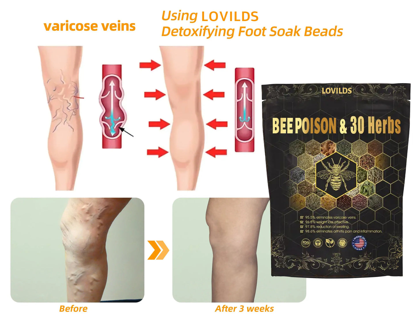 Last day to get 70% OFF: LOVILDS® Bee Poison & 30-Herb Detox Foot Soak Beads for Body Sculpting- Recommended by the America Lymphatic Academy (ALA) 🧀