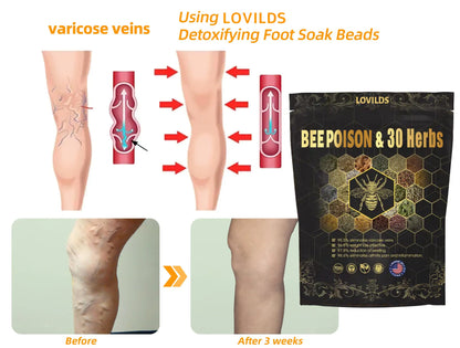 Last day to get 70% OFF: LOVILDS® Bee Poison & 30-Herb Detox Foot Soak Beads for Body Sculpting- Recommended by the America Lymphatic Academy (ALA) 🧀