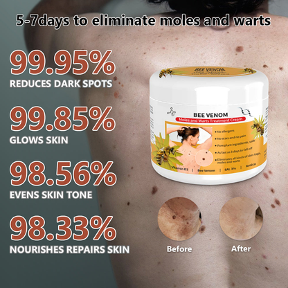 🐝🐝Bee Venom Mole and Wart Treatment Cream