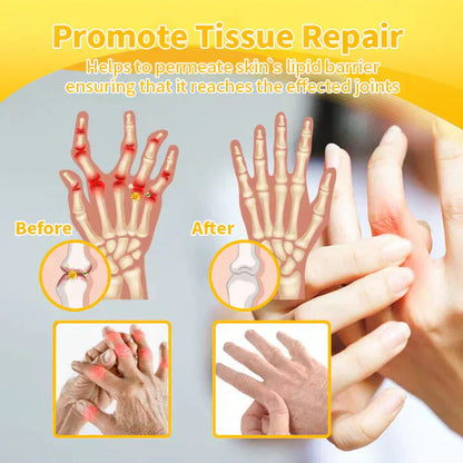 VENOLYX™ Bee Venom Rapid Therapy Joint Cream｜Deep Penetration for Joint Repair