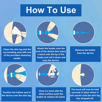 🔥[Official Brand Store] QIAWI™ Skin Tag Removal Kit - Pain-Free, Fast & Effective