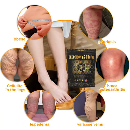 Last day to get 70% OFF: LOVILDS® Bee Poison & 30-Herb Detox Foot Soak Beads for Body Sculpting- Recommended by the America Lymphatic Academy (ALA) 🧀