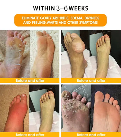 Last day to get 70% OFF: LOVILDS® Bee Poison & 30-Herb Detox Foot Soak Beads for Body Sculpting- Recommended by the America Lymphatic Academy (ALA) 🧀
