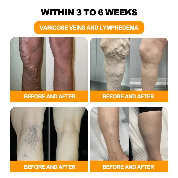 Last day to get 70% OFF: LOVILDS® Bee Poison & 30-Herb Detox Foot Soak Beads for Body Sculpting- Recommended by the America Lymphatic Academy (ALA) 🧀